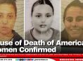 Cause of Death of American Women Confirmed