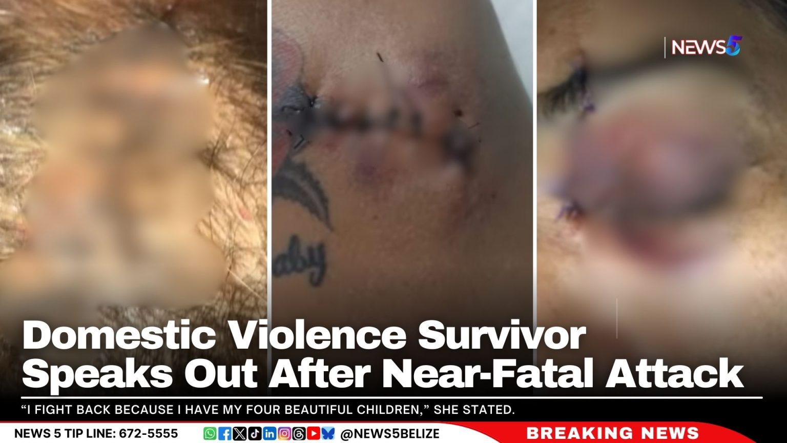 Domestic Violence Survivor Speaks Out After Near-Fatal Attack | Greater ...