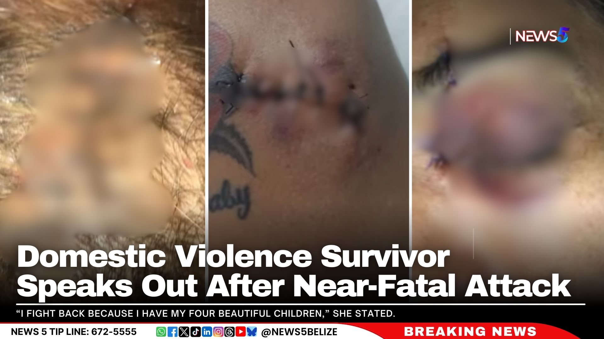 Domestic Violence Survivor Speaks Out After Near-Fatal Attack