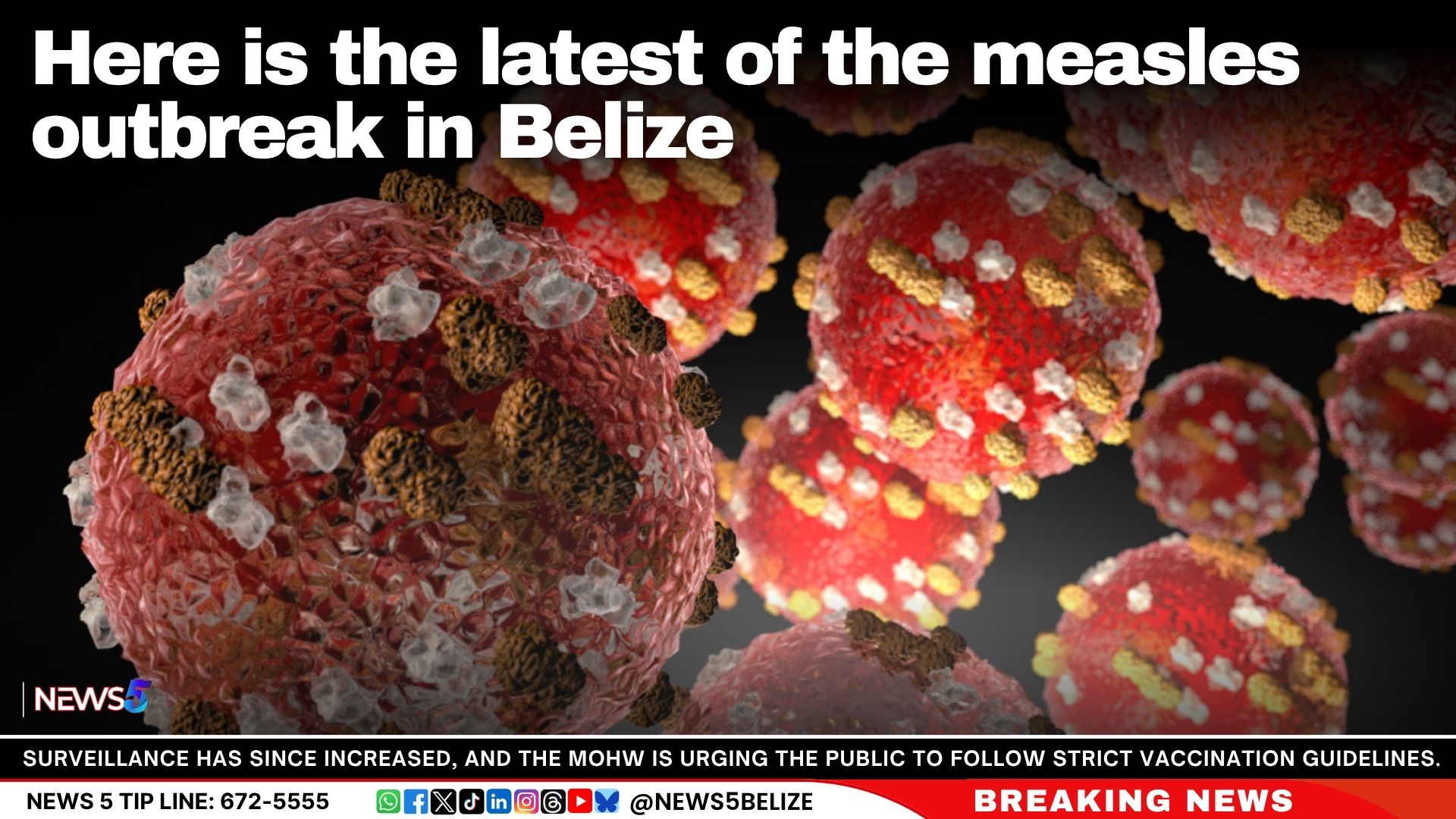 Here is the latest of the measles outbreak in Belize