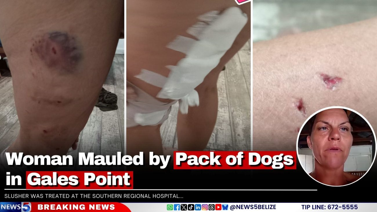Woman Mauled by Pack of Dogs in Gales Point