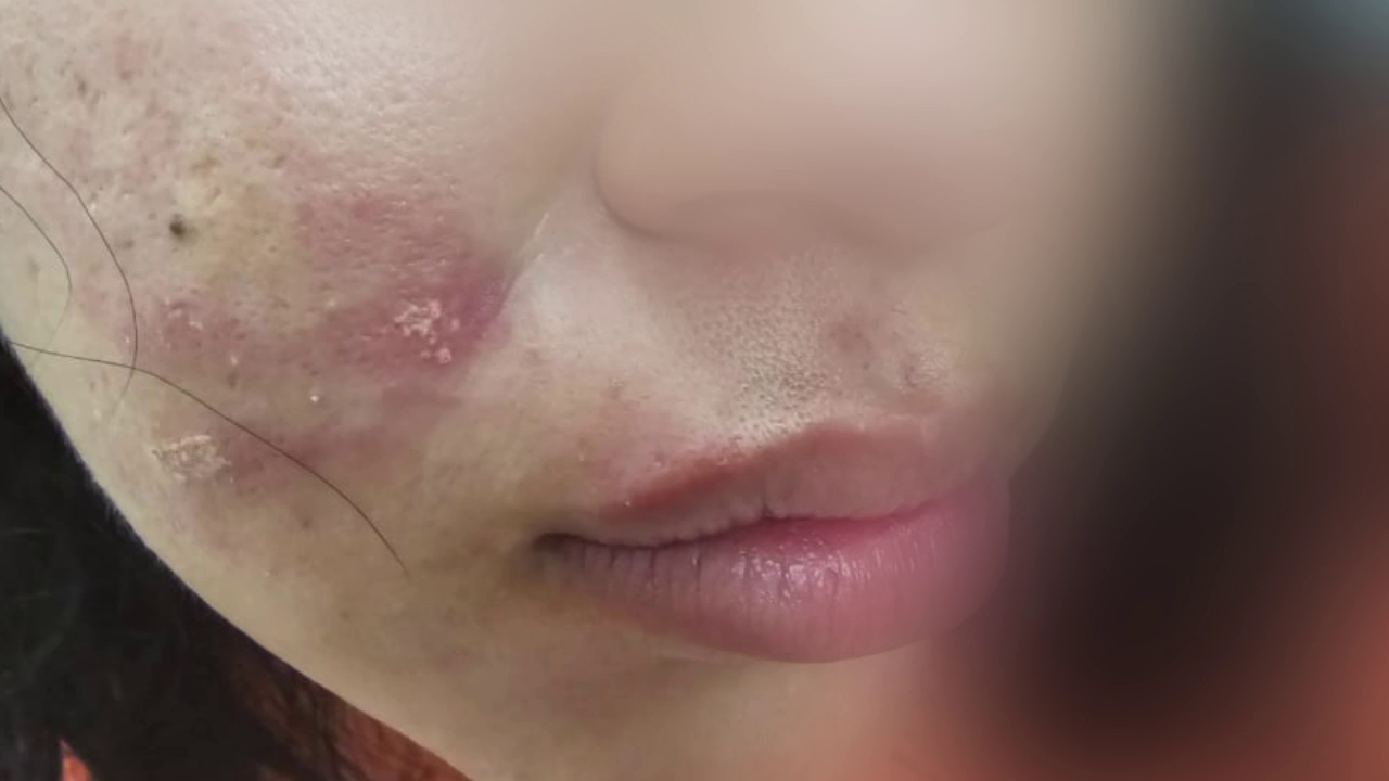 Mujer denuncia brutal agresión por parte de su esposo, juez de paz