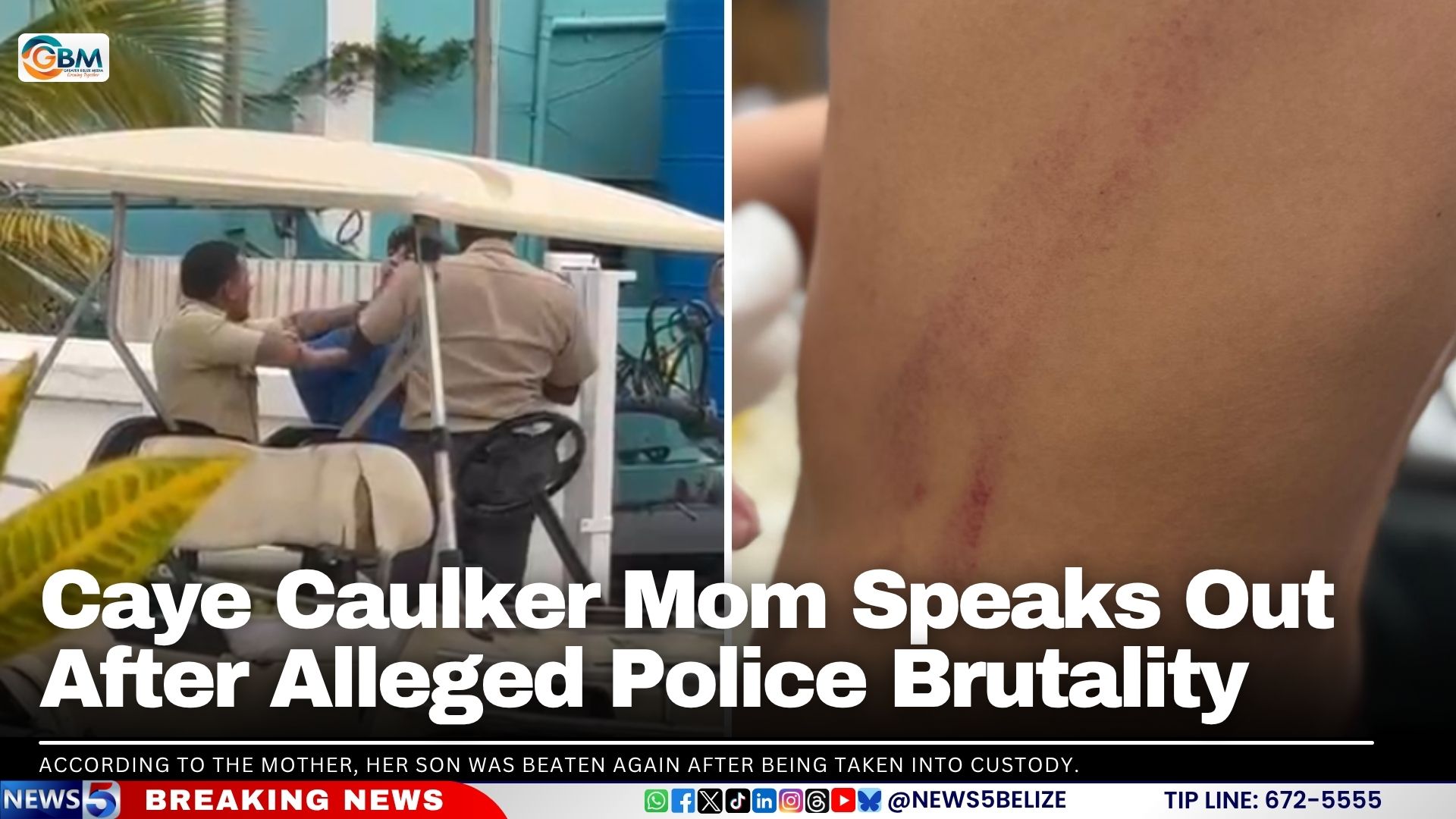 Caye Caulker Mom Speaks Out After Alleged Police Brutality