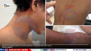 Caye Caulker Mom Speaks Out After Alleged Police Brutality 