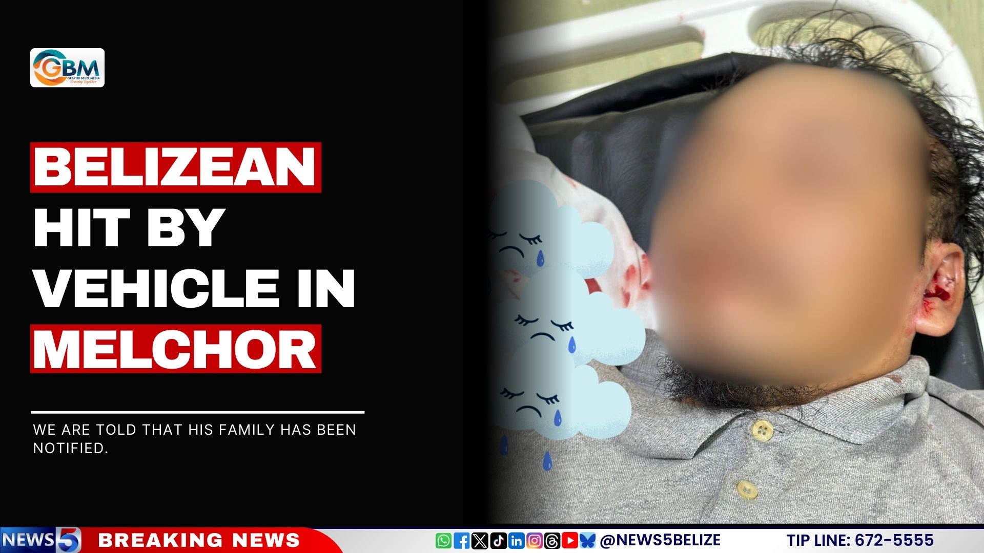 Belizean Hit by Vehicle in Melchor