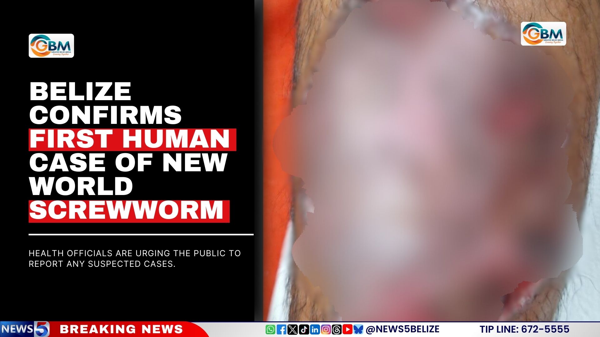 Belize Confirms First Human Case of New World Screwworm