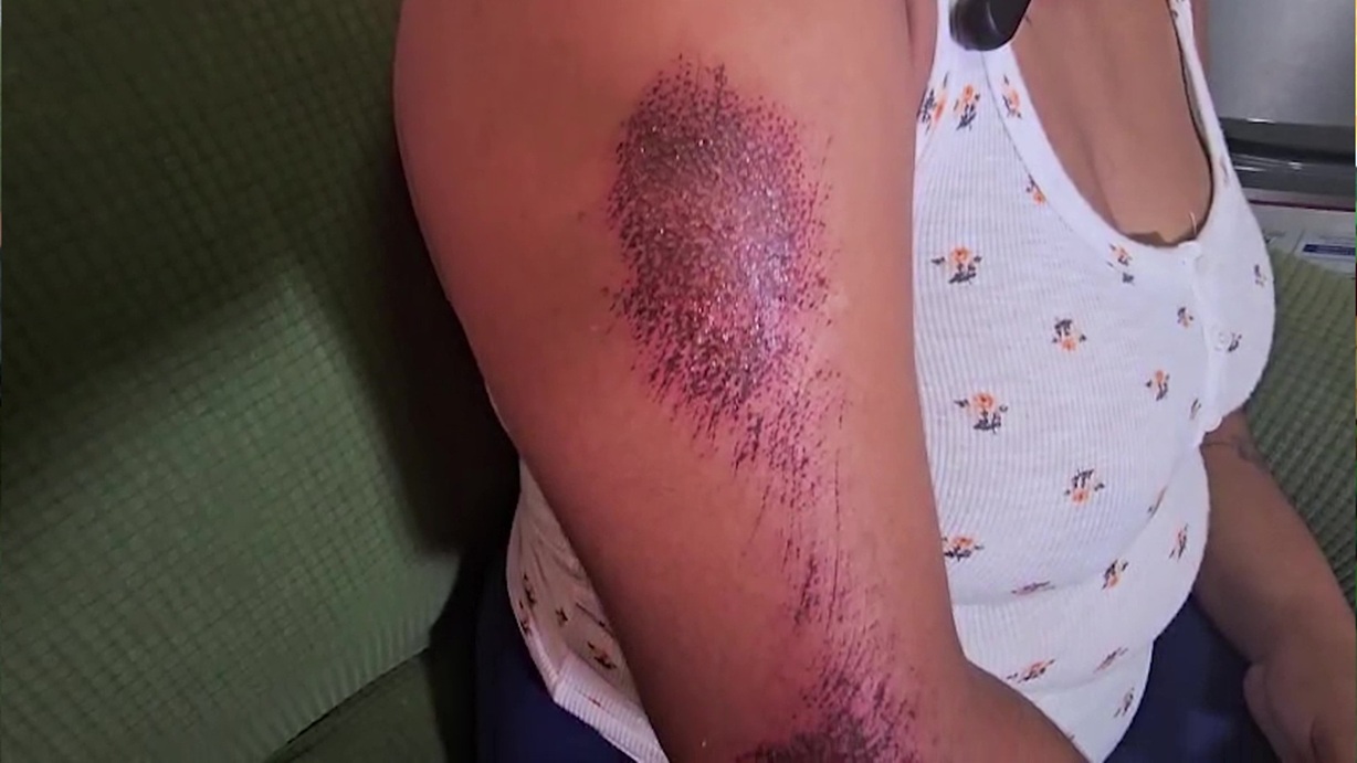 Speeding Vehicles Nearly Kill Belize City Woman