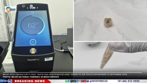 DNA Testing Comes to Belize: A Single Hair Strand Could Solve a Crime