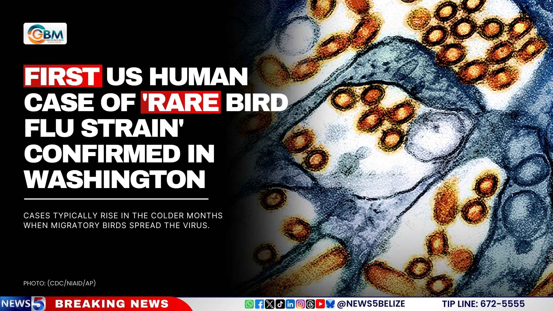 First US Human Case of 'Rare Bird Flu Strain' Confirmed in Washington
