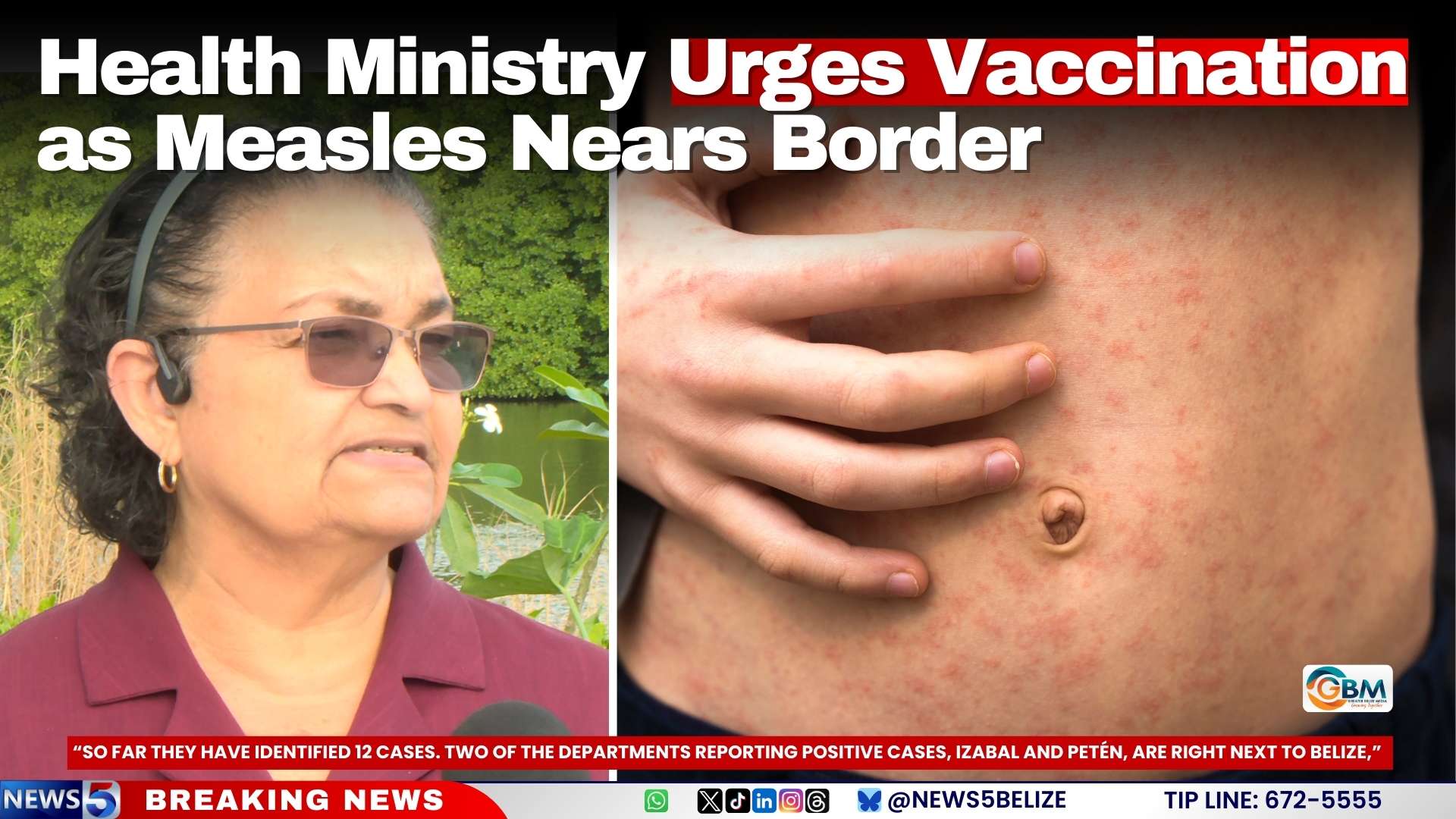 Health Ministry Urges Vaccination as Measles Nears Border