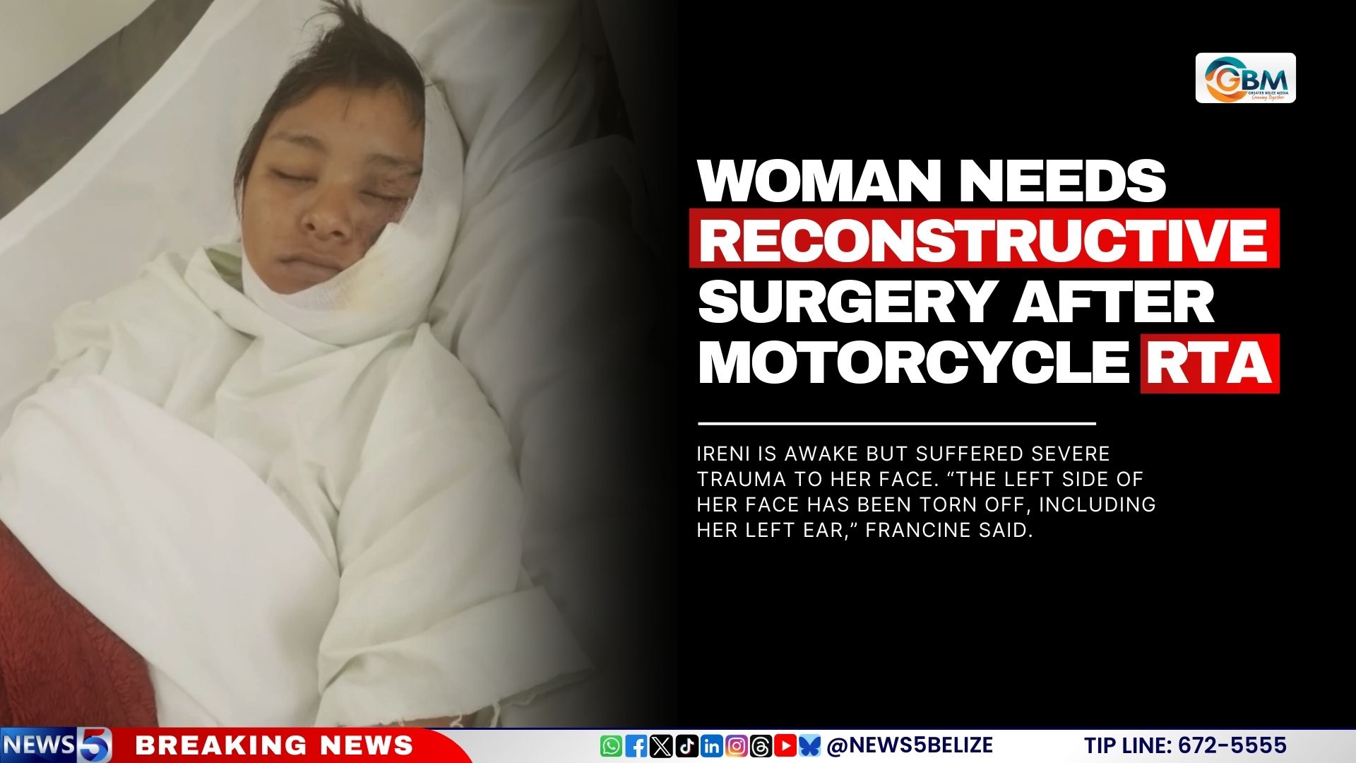 Woman Needs Reconstructive Surgery After Motorcycle RTA