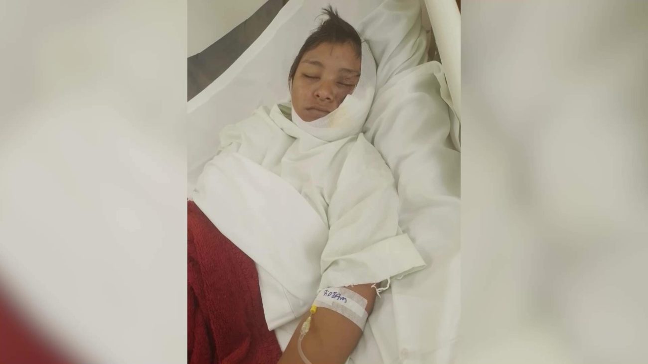 Big Falls Crash Victim Faces Long Recovery