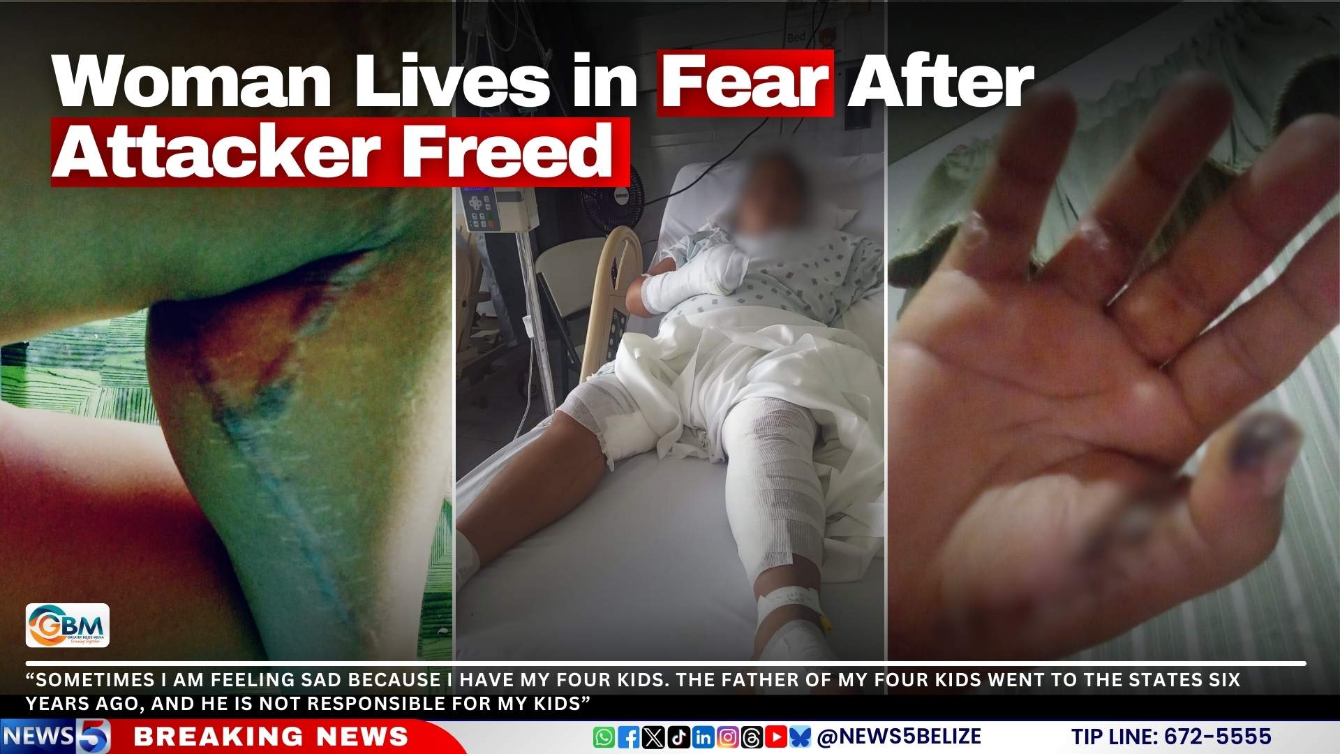 Woman Lives in Fear After Attacker Freed