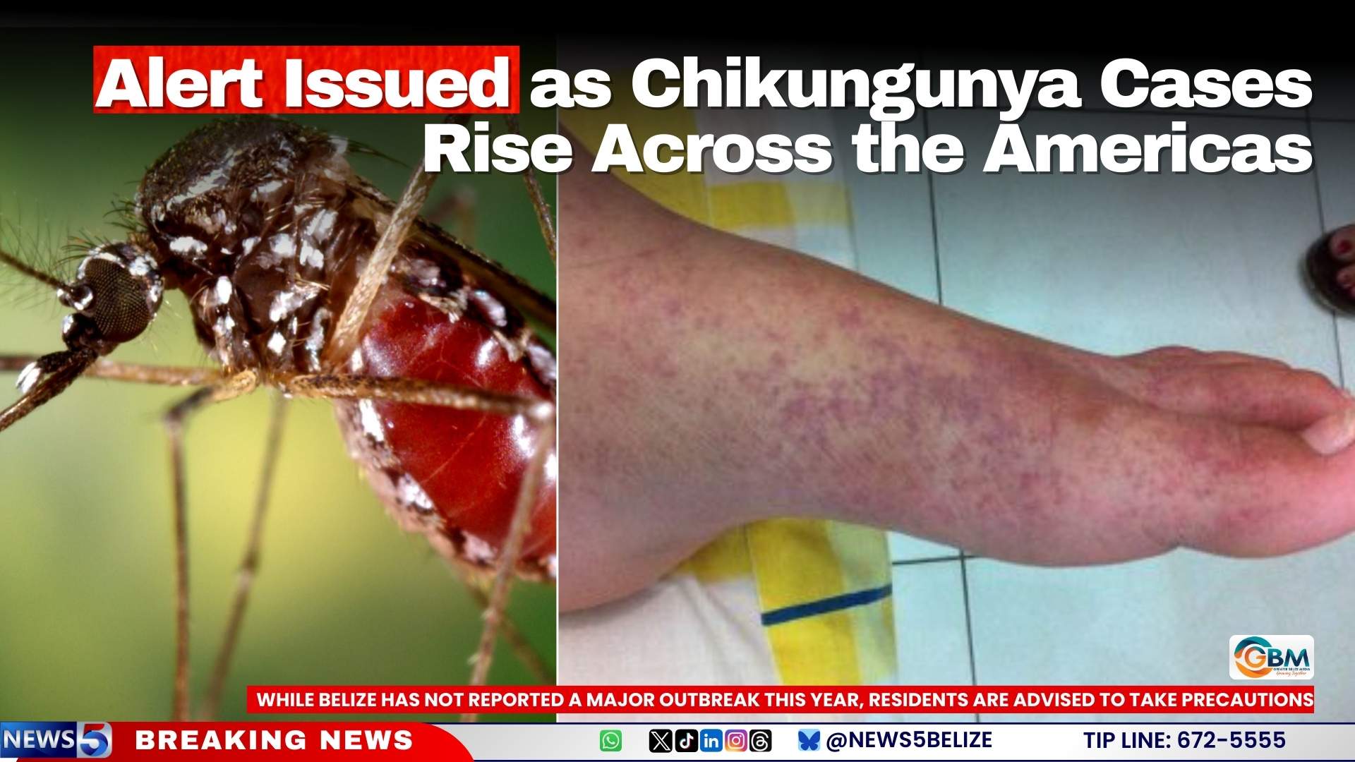 Alert Issued as Chikungunya Cases Rise Across the Americas