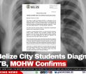 Two Belize City Students Diagnosed with TB, MOHW Confirms