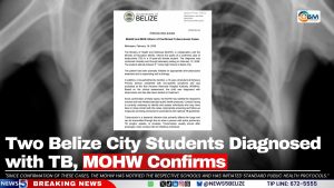 Two Belize City Students Diagnosed with TB, MOHW Confirms