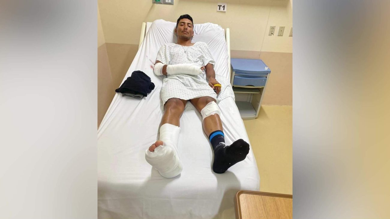 Serious Injuries After Mountain Pine Ridge Cycling Crash