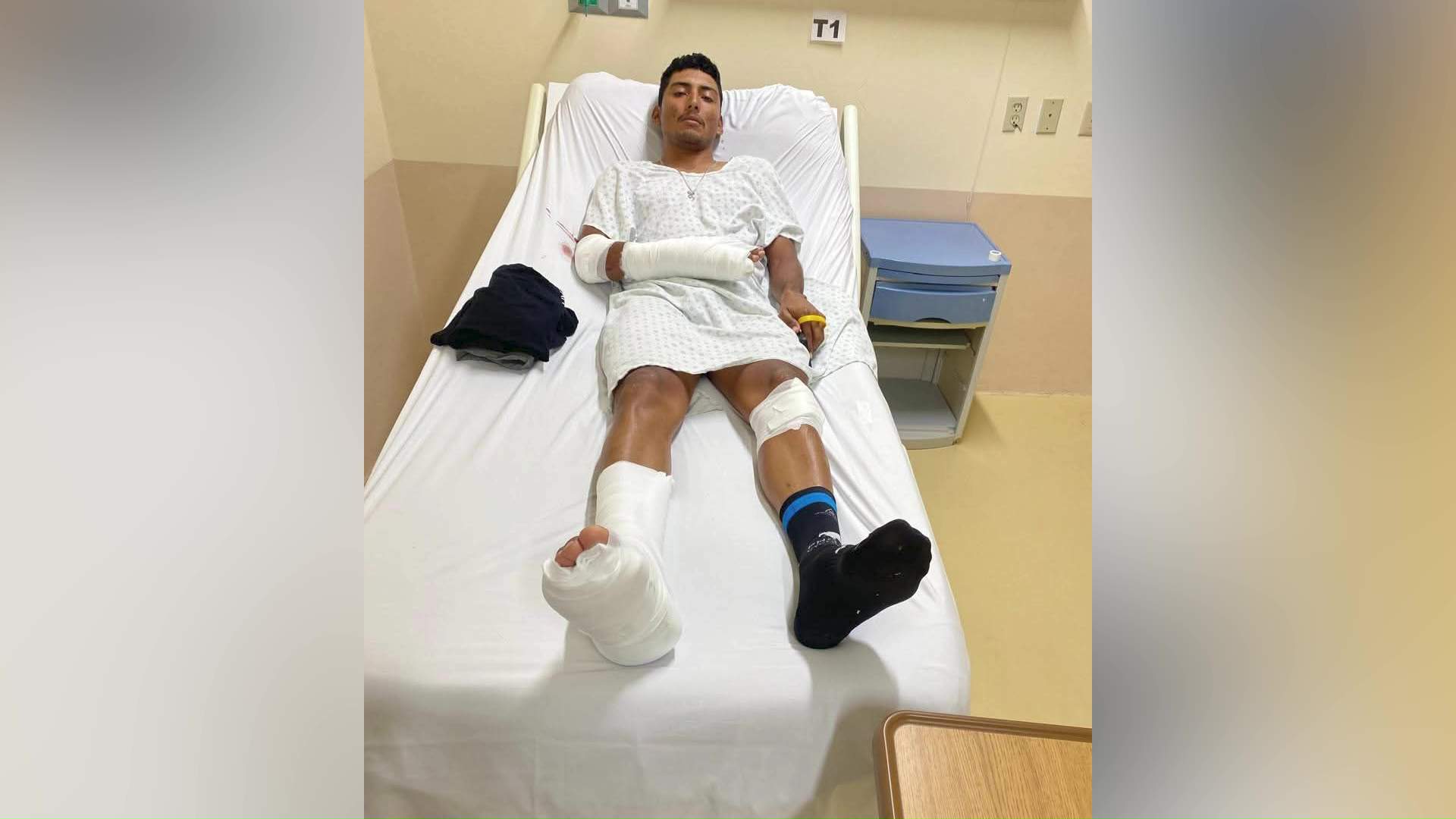 Serious Injuries After Mountain Pine Ridge Cycling Crash