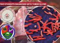 Two Students Diagnosed With Tuberculosis