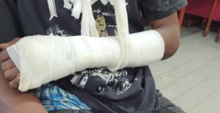 Denuncian brutalidad policial en Gales Point