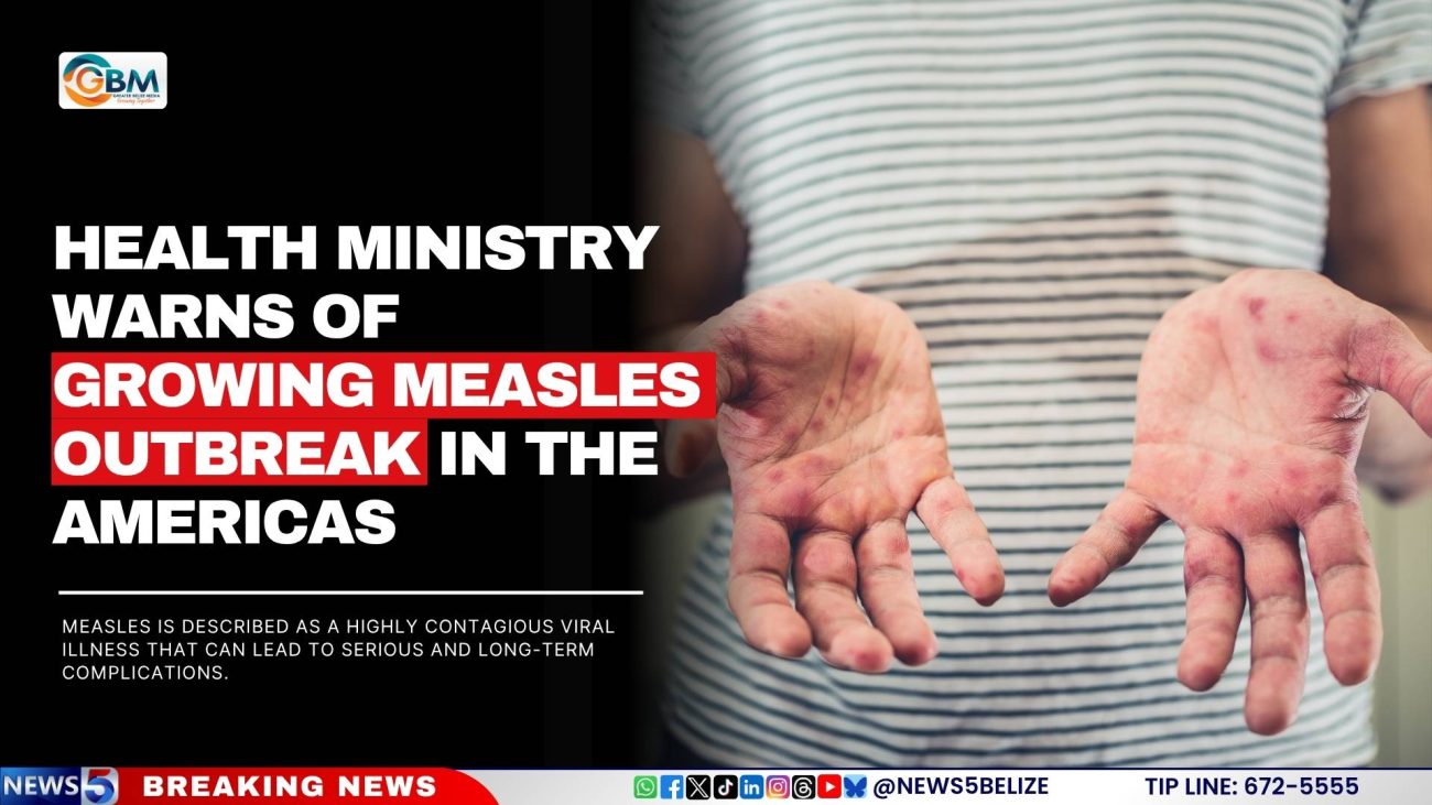 Health Ministry Warns of Growing Measles Outbreak in the Americas