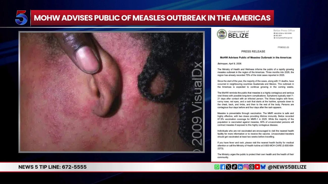 Regional Measles Spike Brings New Health Warning for Belizeans