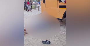 17‑Year‑Old Dies After Motorcycle Crashes Into Bus