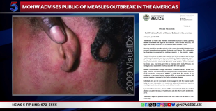 Health Officials Respond to Imported Measles Case in Punta Gorda