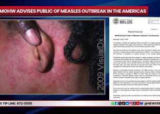 Health Officials Respond to Imported Measles Case in Punta Gorda