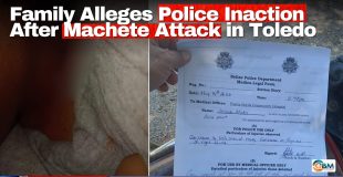 Family Alleges Police Inaction After Machete Attack in Toledo