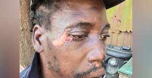 Nightclub Clash Lands ‘Horse’ Garnett Before Court