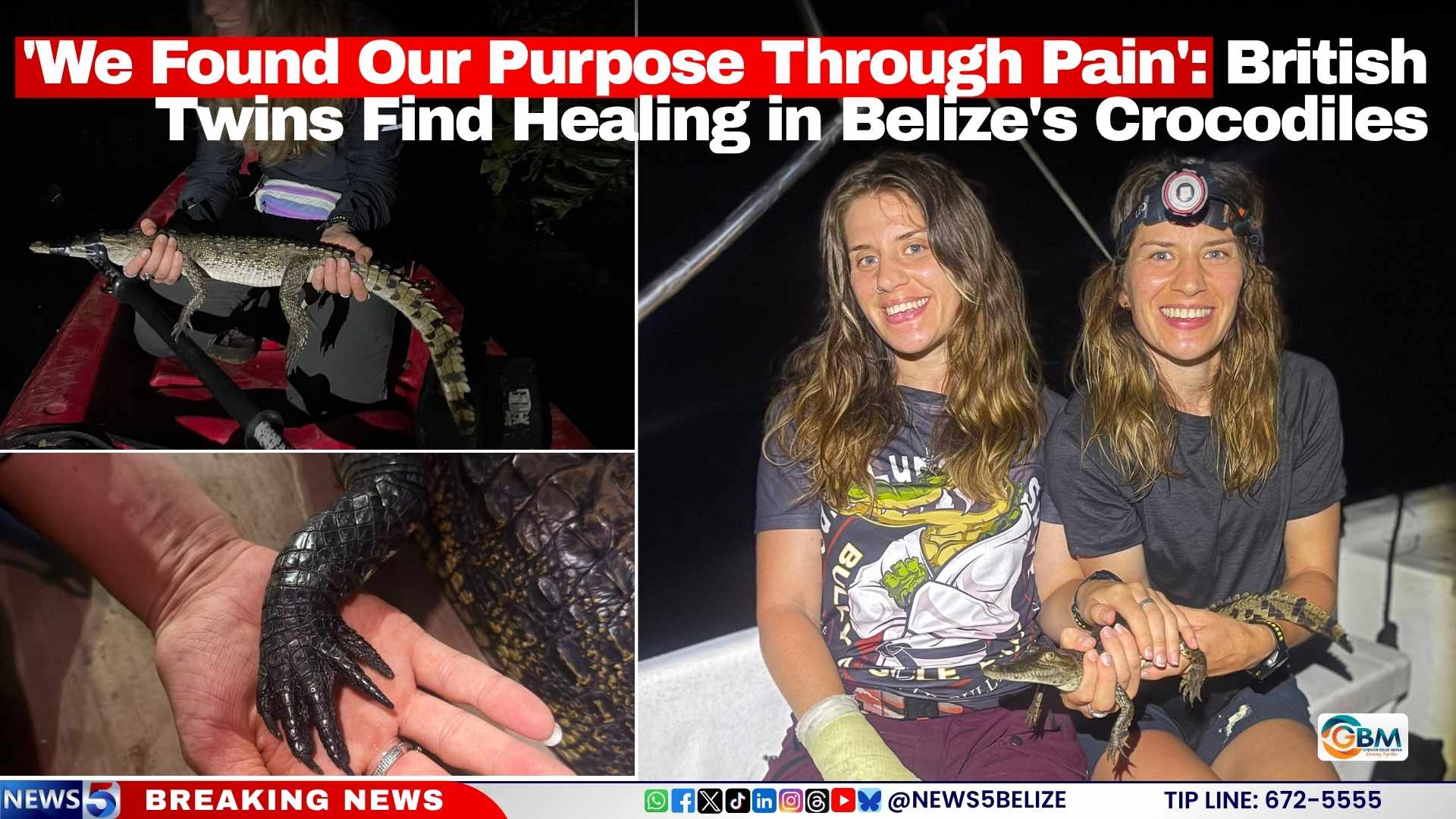 'We Found Our Purpose Through Pain': British Twins Find Healing in Belize's Crocodiles