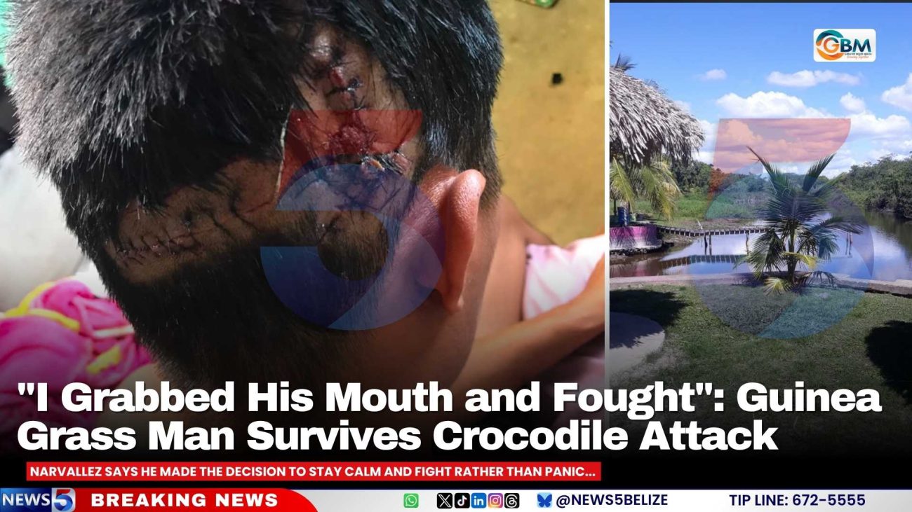 "I Grabbed His Mouth and Fought": Guinea Grass Man Survives Crocodile Attack