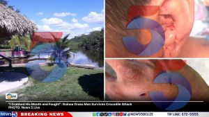 "I Grabbed His Mouth and Fought": Guinea Grass Man Survives Crocodile Attack