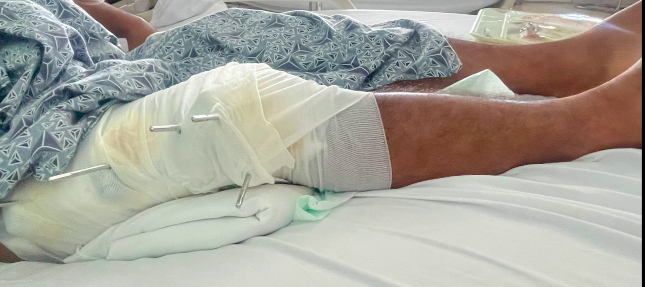 Pomona Farmer Shot by Plainclothes Policemen