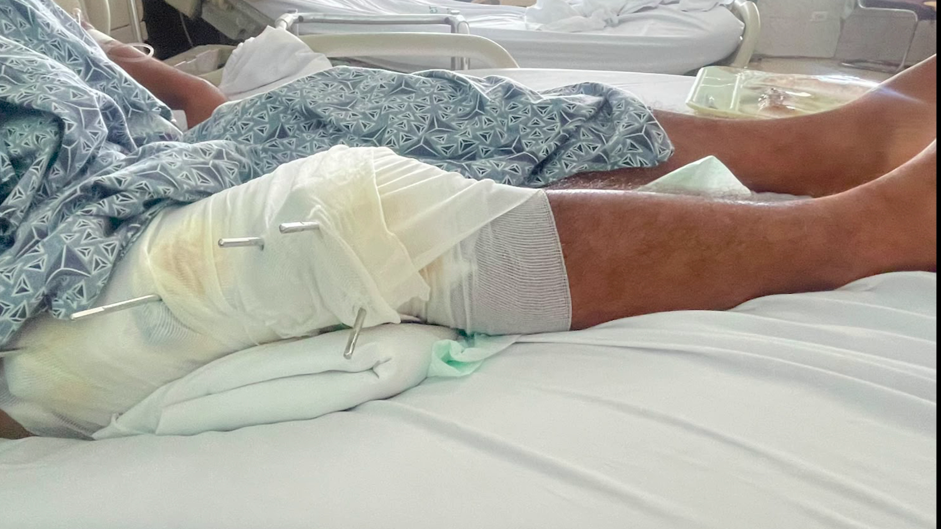 Pomona Farmer Shot by Plainclothes Policemen