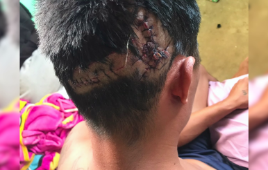 Guinea Grass Man Survives Crocodile Attack at New River Park