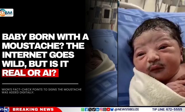 Baby Born With a Moustache? The Internet Goes Wild, but Is It Real or AI?